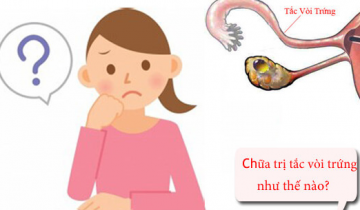 điều trị tắc vòi trứng như thế nào